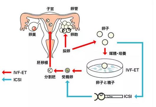 美国双胞胎试管婴儿机构
：美国试管婴儿周期与成功率有一定的关系