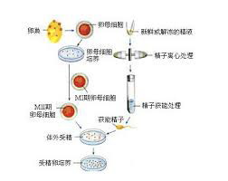 美国40岁供卵流程_在美国分娩的优势